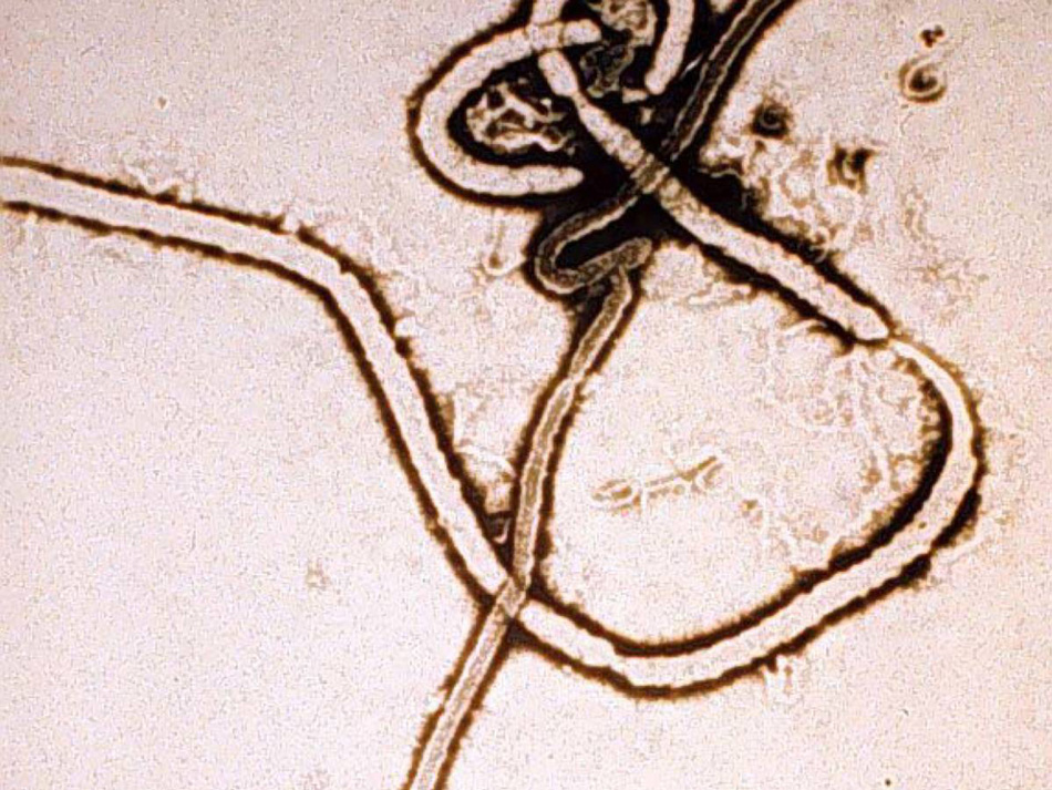 Происхождение
Вирус, до этого называвшийся заирским, получил название в честь места, где была зафиксирована его первая вспышка — неподалеку от реки Эбола в верховье Монгалы, одного из притоков реки Конго. В некоторых случаях смертность от него достигала 90%.