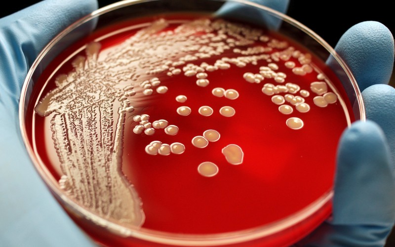 Стойкие бактерии
Недавно врачи обнаружили, что некоторые виды микроорганизмов, вызывающих инфекции, стали устойчивы даже к самым сильным антибиотикам. Выработав такую потрясающую защиту, они, с точки зрения генетики, нас перехитрили. Механизм защиты от лекарств передается микроорганизмами следующим поколениям, ставя под угрозу наше существование. Согласно имеющимся у инфекционного общества здравоохранения данным, из-за устойчивых к антибиотикам бактерий может умереть до 350 миллионов человек к 2050 году.