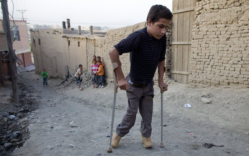 Полиомиелит
Это страшное заболевание оставляет человека парализованным, или убивает его вовсе. К счастью, полиомиелит практически побежден — за три последних десятилетия врачи спасли практически 99% заболевших. По состоянию на прошлый год, регулярные вспышки полиомиелита зафиксированы всего в 3 странах: Нигерия, Пакистан и Афганистан.