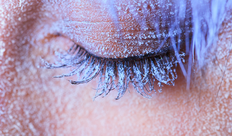 Степени и признаки обморожения
Холод способен вызвать необратимые изменения в мягких тканях. Пережатые кровеносные сосуды просто перекрывают доступ крови, вызывая омертвение ткани. Дальше мы расскажем вам о степенях обморожения и способах лечения.