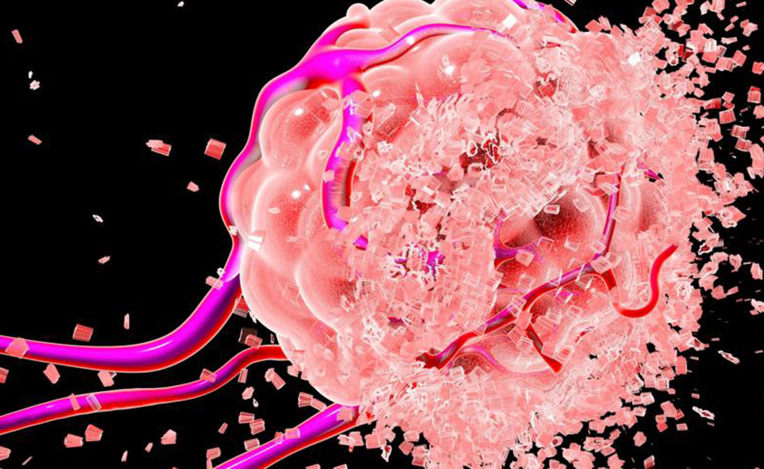 Сложные организмы
Рак является неудачной ветвью эволюционного развития — и атакует он только сложные организмы, вроде человеческого тела. Чтобы понять, как появился рак, а значит и разработать действенные способы лечения, ученым и врачам приходиться возвращаться к самым фундаментальным процессам, протекающим в наших организмам: делению клеток.