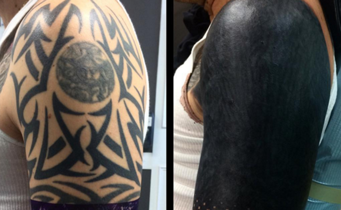 Кавер
Как правило, люди начинают задумываться о черной татуировке в качестве кавер-апа надоевшей, или просто неудачной работе. Можно, конечно, просто покрыть все место черной краской, а можно сделать это так, чтобы получилось новое произведение искусства.