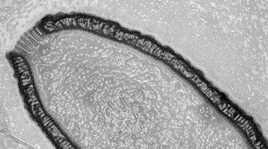 Жуткий вирус
Пожалуй, самая неприятная находка в нашем списке. Ученые из Марсельского университета совместно с российскими биологами открыли гигантский вирус в сибирских льдах. Для организма такого рода Pithovirus sibericum просто огромен, его размеры — 1,5х0,5мкм